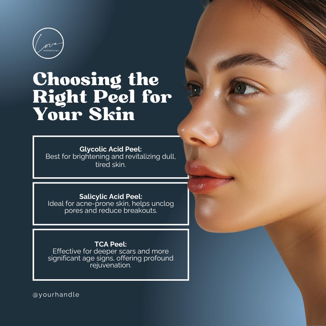 30 Chemical Peel Social Media Templates | Skincare Marketing Canva Pack for Estheticians & Med Spas - Social Canvas